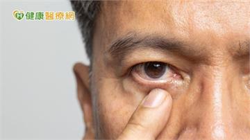 為何青光眼一定要控眼壓？醫解析「青光眼導流支架」微創手術新選擇！