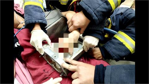 百年餅店驚傳意外! 女員工"手卡機器"3指骨頭碎裂