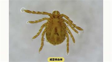 北部7旬男罹SFTS！疾管署：本土感染風險中度　戶外慎防蜱蟲叮咬