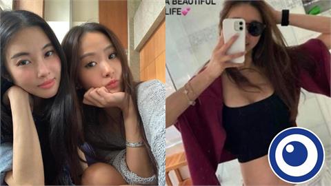 孫芸芸49歲親姊「腎臟移植980天」認了！社群突PO照「傷疤」不藏了