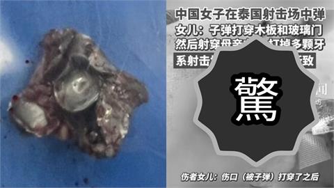 射擊場爆流彈意外！中國女遊客遭擊中「子彈穿臉留黑洞」驚悚照片曝光