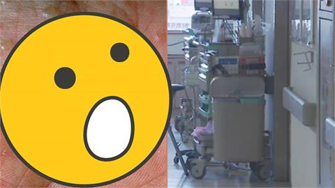 長出小顆粒「癢到抓不停」吃巧克力也中招！醫示警「4大族群」高風險