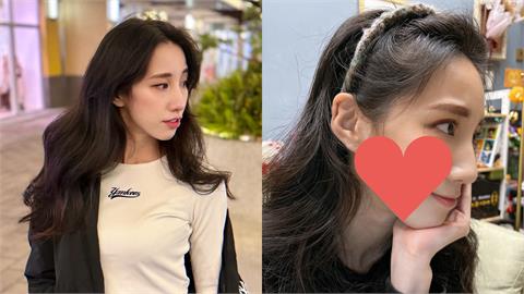 瑤瑤過年前臉毀了！突現「詭異三角形疤痕」她急求救：不知道會不會消