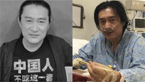 黃安中國開唱遭轟下台！近況失聲、長骨刺「急就醫」醫籲：1情況恐失禁、癱瘓