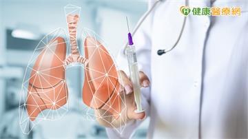65歲男健檢揪出0.9公分肺結節！AI輔助3D影像協助肺段切除評估