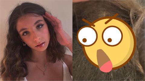 美女治療師翻開13歲女孩兒長髮「驚見頭蝨」　網友看傻：洗頭很困難嗎？