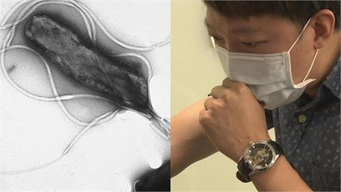 全台每2人就有1人中鏢！醫揭「隱形胃殺手」染上沒感覺⋯醫示警4類人要小心