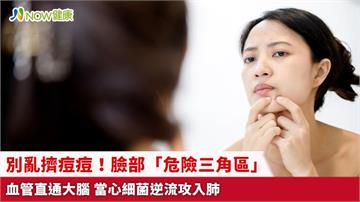別亂擠痘痘！臉部「危險三角區」血管直通大腦 當心細菌逆流攻入肺