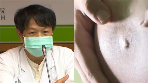 孕媽咪一進診間就狂落淚…醫生點名「婆婆介入教養方式」成最常見壓力源