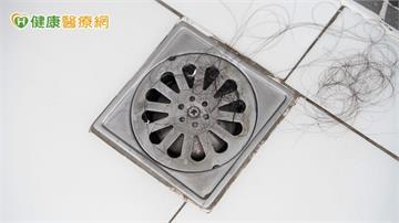 洗完頭發現排水孔都是頭髮？中醫解析4大掉髮類型　圓形禿別輕忽