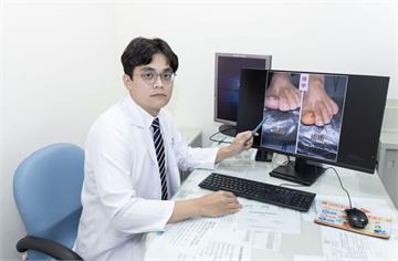 長時間穿「大頭鞋」出大事！   熟男慘拔4次趾甲仍不斷甲溝炎