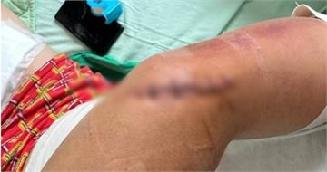 國道服務區爆砍人！男遇襲大腿驚見「12公分傷」　警全力緝兇中