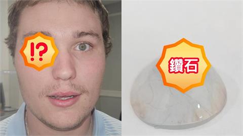 美國珠寶師右眼竟見「2克拉真鑽」!砸6千萬打造「鑽石義眼」網驚:像電影反派