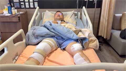 毒駕撞斷所長腿"無保請回"拎水果求原諒 家屬:無福消受