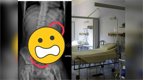 11歲男童3C成癮引「4症狀」急送醫　照X光驚見「排泄物」滿至胸部！