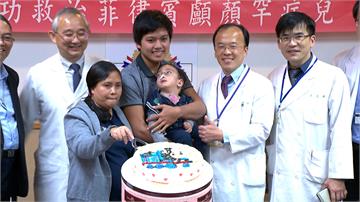 台灣再展醫療實力 成功救治菲律賓顱顏罕病兒