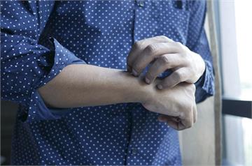 蕁麻疹發作不只皮膚症狀！   她「喉嚨腫脹、呼吸困難」三度送急診