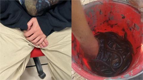 男遭30cm活黃鱔「鑽入後門」肚子硬爆險沒命！醫手術見1畫面傻眼：不是開玩笑