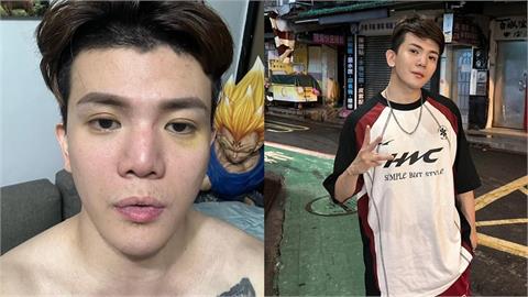 孫生性騷炎上「酷炫急道歉」！網不買單曝光1解方：放棄易科罰金進去關