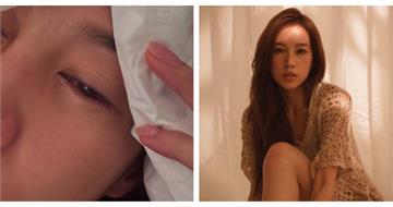 只換件衣服竟割傷眼角膜！女星眼傷惡化痛到哭　醫：恐永久損傷
