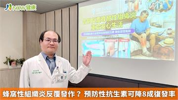 蜂窩性組織炎反覆發作？ 預防性抗生素可降8成復發率