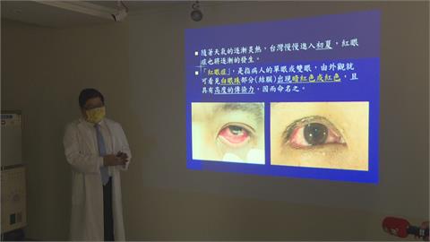 雙眼紅通通勿輕忽！女子自行點藥未改善　就醫竟罹甲狀腺眼癌