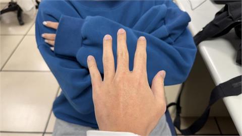 牙醫送紅包給女員工「假告別真猥褻」！下秒「摘罩強吻」喊：可以再放肆點嗎？