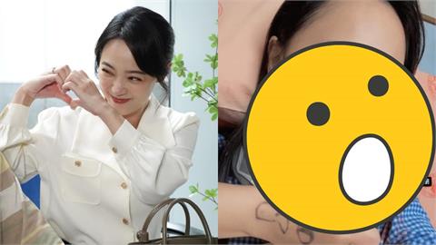 勇兔突「緊急動刀」病況震撼粉絲!私下「素顏躺病床」畫面流出