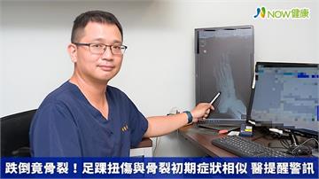 跌倒竟骨裂！足踝扭傷與骨裂初期症狀相似 醫提醒警訊