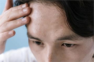 鏟子超人返家後「中暑肌痛」怎辦? 中醫2招自救有效