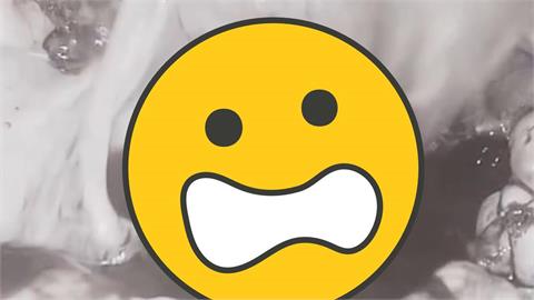 情侶認識20天「激戰太猛」撞破了！腹腔「全是血色積液」驚人畫面流出