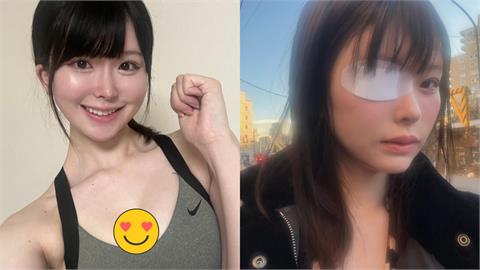 日女優慘變「獨眼龍」心酸內幕曝！昔為牛郎前男友「月燒千萬、斷聯友人」