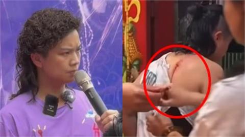 尬電師父「砍背滴血」信眾整杯喝完！取血過程全曝光…台東縣衛生局出手了