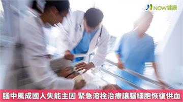 腦中風成國人失能主因 緊急溶栓治療讓腦細胞恢復供血