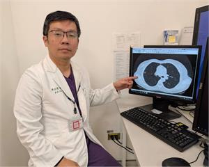 不抽菸也有風險　恩主公醫院示警肺癌家族史關鍵