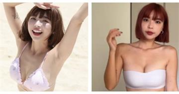 YouTuber一隻阿圓抗癌故事曝　2歲切除右腎「疤痕是活下來的證明」