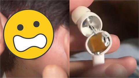 睡到一半耳邊傳巨響！中國「百萬熱銷藍牙耳機」瞬炸　男大生險失聰