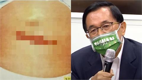 關鍵今日／319槍擊案藏紅色陰影！疑為「中共背後指使」驚人內幕一次看