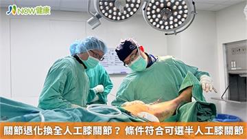 關節退化換全人工膝關節? 條件符合可選半人工膝關節