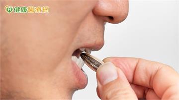 壯年主管牙痛半年查無原因　原來是牙根縱裂惹禍