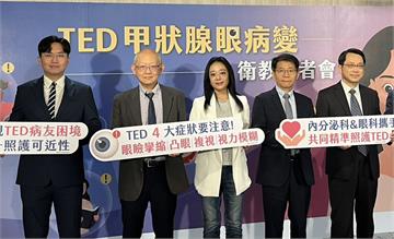 金鐘影后照鏡「雙眼高低不一」竟罕見眼疾！   4大警訊常被忽略