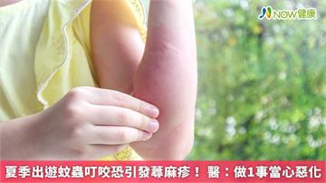 夏季出遊蚊蟲叮咬恐引發蕁麻疹！ 醫：做1事當心惡化