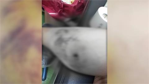 嚇人！彰化和美１５隻惡犬遊蕩　民眾遭追咬事件頻傳