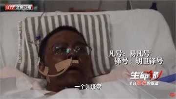 武肺病毒攻擊人體多處！中國2醫生肝功能受損全身暗沉