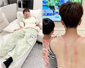 蔡阿嘎疑「耳石脫落」頭暈目眩　自曝暈了一整天都沒好