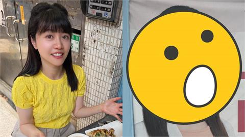 高嘉瑜「臉蛋遭毀」本人親發聲！「最新現況曝光」網急關心：以為是濾鏡