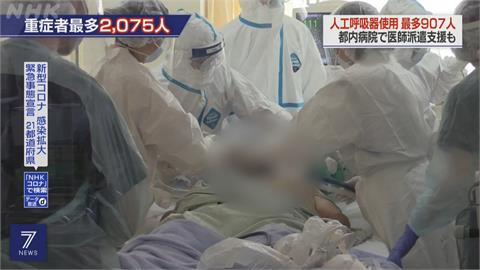 日本驗出首例Delta再變種！　確診者無出國史