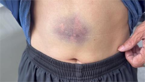 惡鄰居! 嫌持木棍猛砸鐵門 男屋主反抗腹部遭打