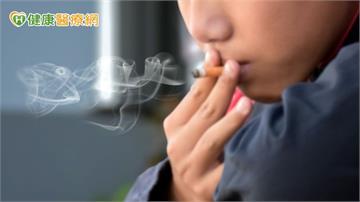 沒有咳嗽也可能有肺癌！醫籲：符合資格者做LDCT篩檢