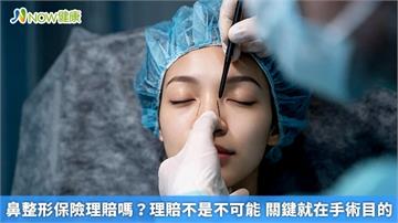 鼻整形保險理賠嗎？理賠不是不可能 關鍵就在手術目的